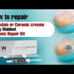 Waldent Ceramic Crown Conditioning Kit