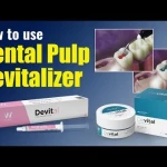 Waldent Devital Pulp Devitalizing Paste