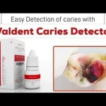 Waldent Caries Detector